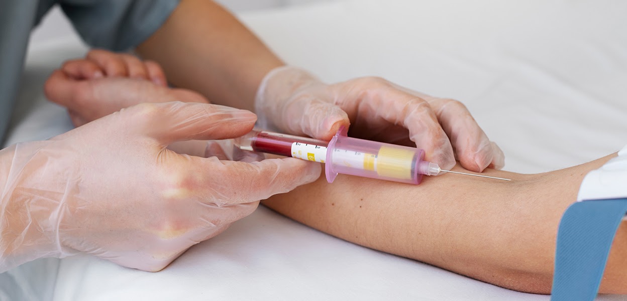 Get A Blood Test To Check Vitamin D Levels